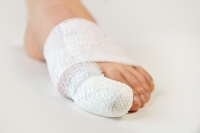 Toe Fractures