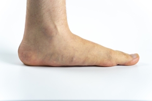 Facts About Flat Feet