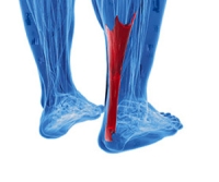 Ways to Diagnose Achilles Tendon Injuries