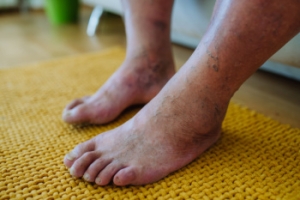 Protect Your Feet and Your Health