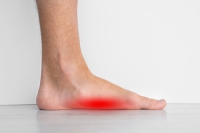 Types of Flat Feet